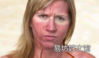 晒黑怎么办 晒黑怎么办才变白