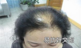 头发稀少怎么办 头发稀少怎么补救