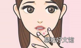 下巴长痤疮怎么办 下巴长痤疮怎么办啊