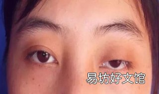 上眼睑下垂怎么办 年纪大了上眼睑下垂怎么办