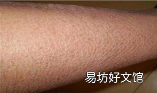 腿部皮肤粗糙怎么办 腿部皮肤粗糙怎么办才能恢复