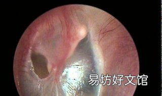 耳膜破了怎么办 小孩掏耳朵耳膜破了怎么办