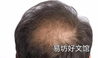 脂溢性脱发怎么办 脂溢性脱发怎么办还能长回来吗