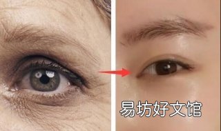 眼部有鱼尾纹怎么办 眼部有鱼尾纹怎么办图片