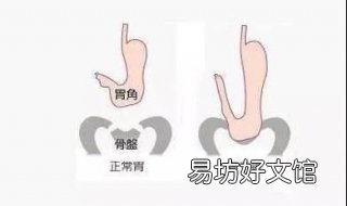 胃下垂怎么办 14岁孩子胃下垂怎么办