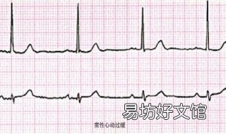 窦性心动过缓怎么办 窦性心动过缓怎样缓解