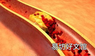 胆固醇高怎么办 低密度脂蛋白胆固醇高怎么办