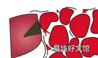 血小板低了怎么办 血小板低了怎么办,需要怎么治疗