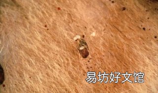 跳蚤咬了怎么办 小孩子身上被跳蚤咬了怎么办
