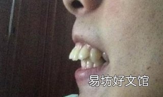 龅牙怎么办 小孩牙齿有点龅牙怎么办