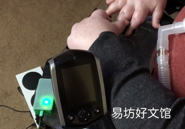 适配器将电动轮椅变成Xbox控制器