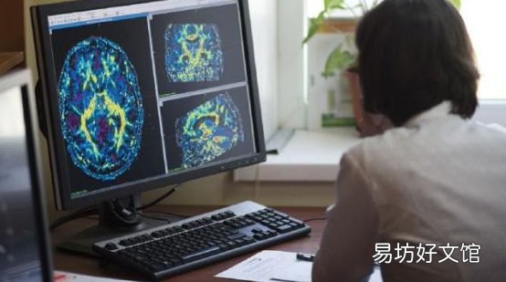 ?放射学中AI的10个关键用途不涉及解释