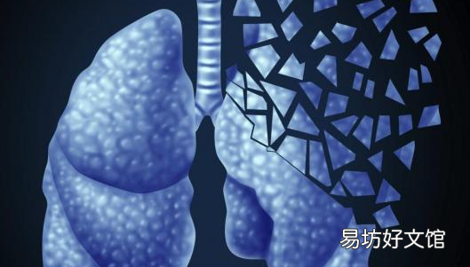 影像专家筹集1100万美元用于人工智能驱动的肺部疾病检测
