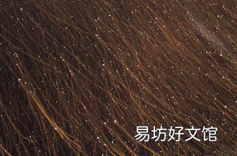 冬季去除头皮屑的小窍门