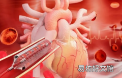 紫杉醇涂层球囊对冠状动脉支架内再狭窄有效