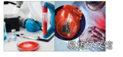 一项简单的血液测试可预测六个月内心脏病发作的风险