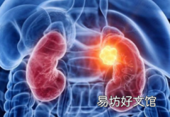 派姆单抗辅助治疗肾癌的生存率有所改善