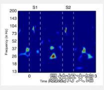 在大脑中β节律的爆发实施认知控制