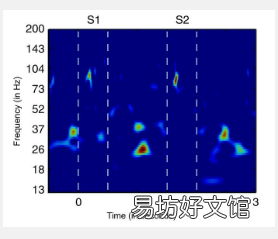 在大脑中β节律的爆发实施认知控制