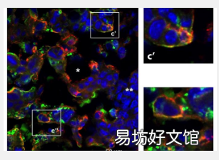 妊娠細胞因子水平影響胎兒大腦發育和后代行為