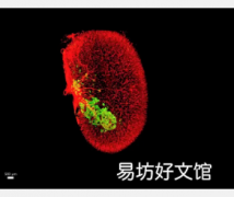 希望之城和西奈山的科学家首次证明联合治疗可以增加体内人类胰岛素分泌细胞