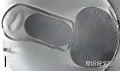 揭开食物致病菌休眠之谜 更有效地消灭它们