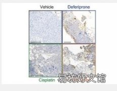 临床前研究探索已批准的卵巢癌药物