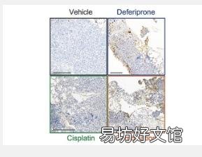 临床前研究探索已批准的卵巢癌药物