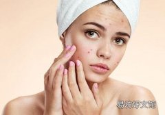 吹空調會長痘痘嗎 怎樣預防吹空調長痘痘
