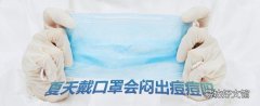 夏天经常戴口罩会闷出痘痘吗 夏天戴口罩能防止晒黑吗