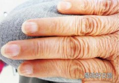 林赛氏指甲有月牙吗 赶紧看看你的指甲有没有月牙！