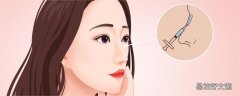 鼻子疤痕增生是什么样子的 鼻子疤痕增生会自己消失吗