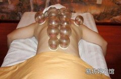 咳嗽拔罐部位图解 咳嗽拔火罐的位置图片