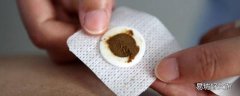 三伏贴适合人群 三伏贴的禁忌是什么