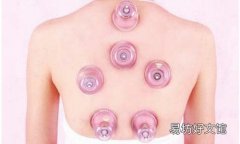 甲亢可以拔罐吗 甲亢可以刮痧颈脖子吗