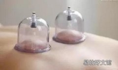 失眠拔罐在什么部位 失眠拔火罐哪个位置图