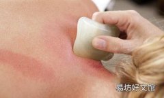 刮痧后可以洗澡吗 刮痧后多久可以洗澡