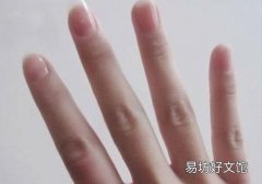 林赛氏指甲的症状 林赛氏指甲怎么办