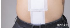 三伏貼小孩多大可以貼 三伏貼任何時候都可以貼嗎