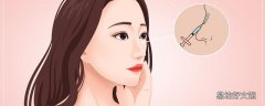 去隆鼻可以改變鼻子的大小嗎 隆鼻是根據(jù)自身鼻型來(lái)的嗎