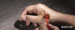 碘伏和酒精哪個對傷口愈合好 酒精消毒好還是碘伏消毒好