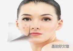 痤瘡長什么樣 痤瘡怎么解決