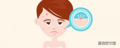 额头上长痘痘跟刘海有关系吗 闭口和痘痘的区别