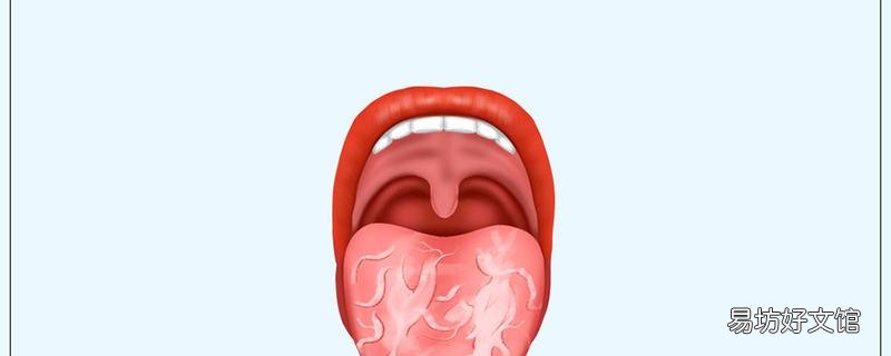 地图舌不能吃什么 地图舌会反复出现吗