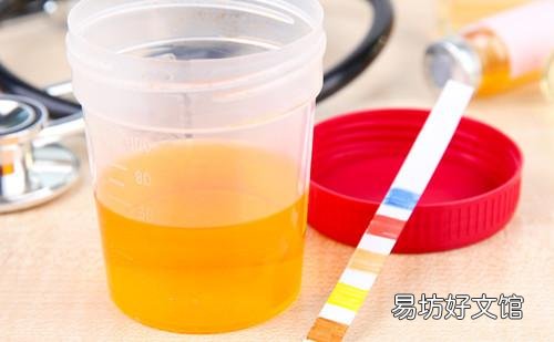 平时怎么判断自己尿酸高不高 尿液分析怎么看尿酸高不高
