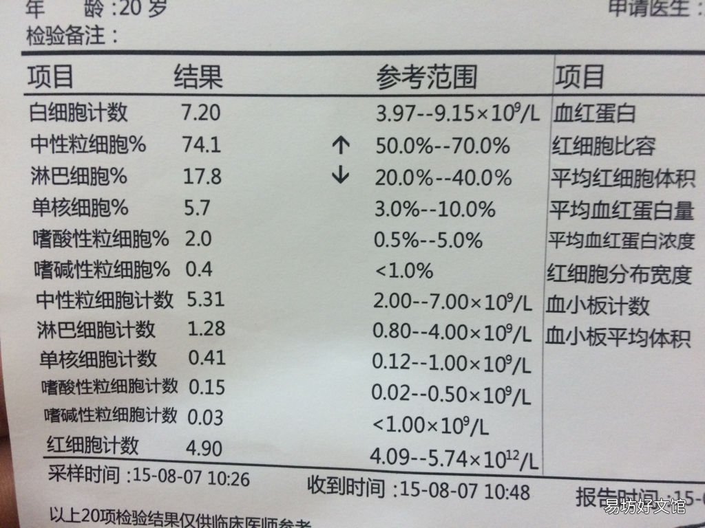 平时怎么判断自己尿酸高不高 尿液分析怎么看尿酸高不高