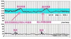 怀孕几个月可以开始做胎心监测检查 怀孕几个月听胎心监测