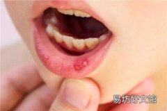 牙龈癌能治愈吗 牙龈癌的早期症状以及预防方法