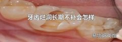 牙齒爛洞長期不補會怎樣