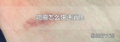 吻痕怎么快速消除